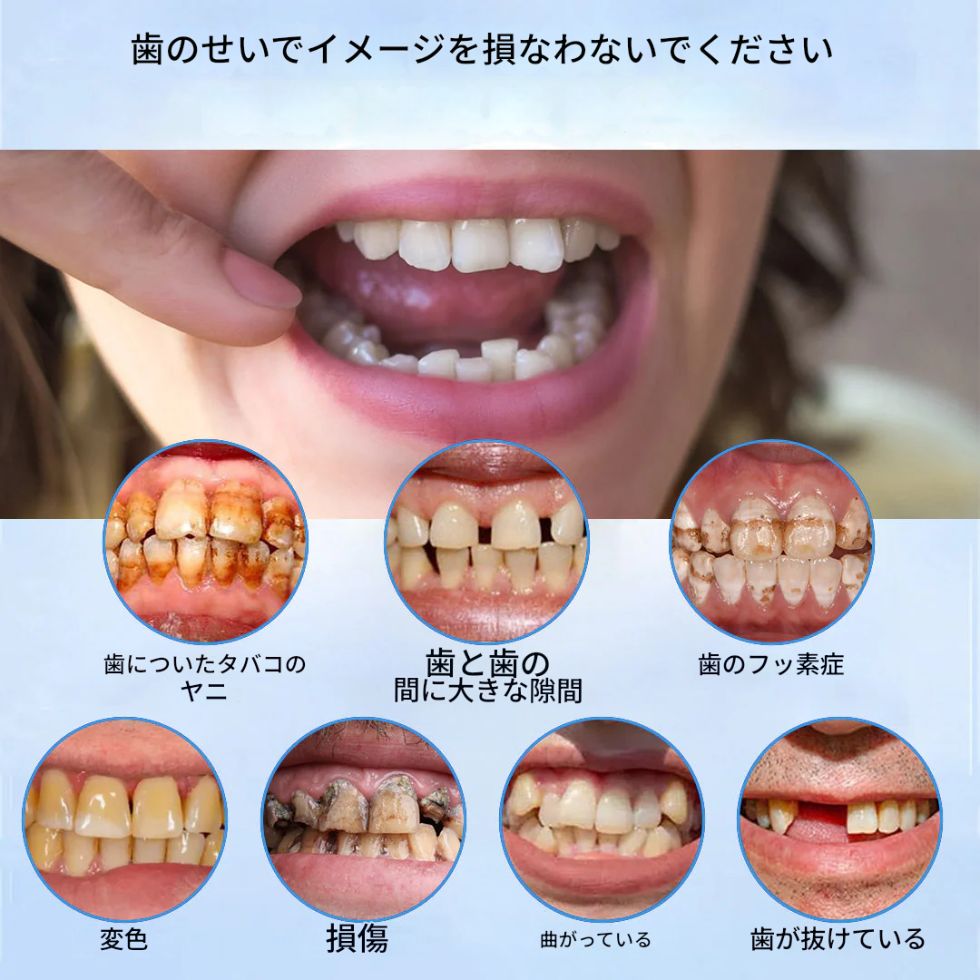 中高年向けセラミック義歯 – 抗菌・防汚仕様（⏰期間限定 – 80%オフ⏰）