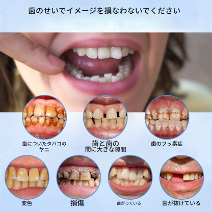 中高年向けセラミック義歯 – 抗菌・防汚仕様（⏰期間限定 – 80%オフ⏰）